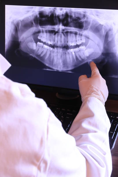 Best Emergency Root Canal Therapy in Omak, WA